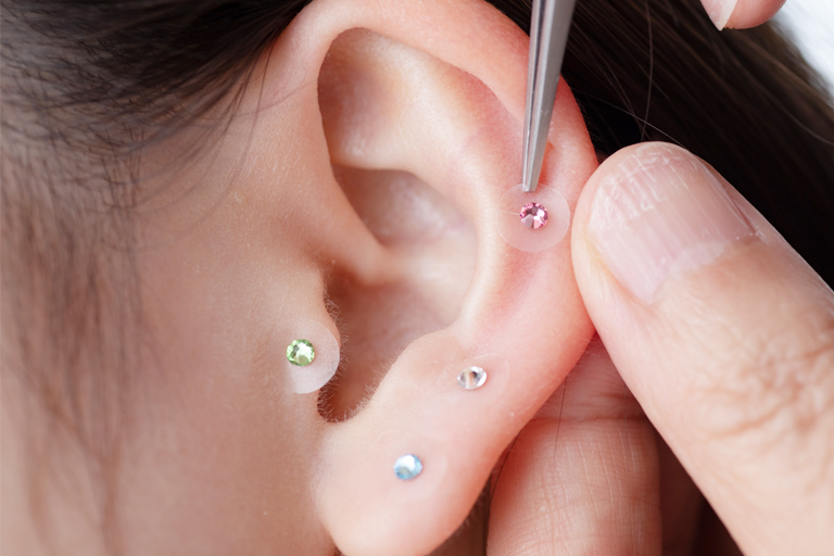 ���ڃW���G���[�Ƃ́H